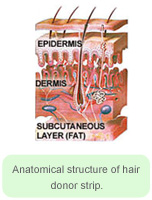 Anatomical Structure of Hair Donor Strip - Hair Transplant Manila Philippines by Manzanares Hair Restoration Center